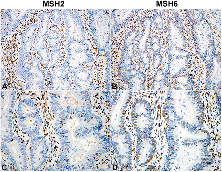 Inside the USCAP Journals Modern Pathology