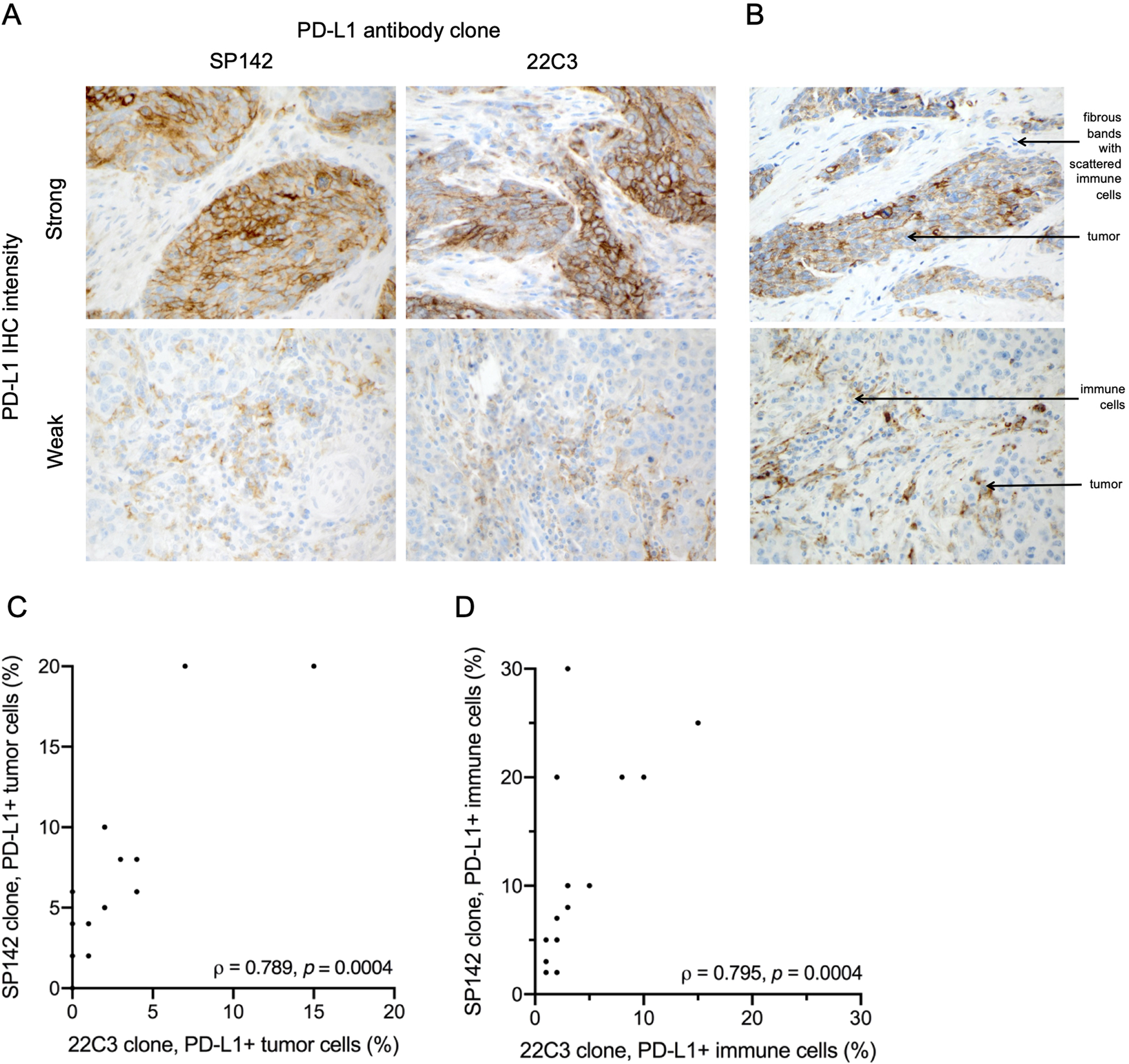 Association of PD-L1 expression by immunohistochemistry and gene microarray  with molecular subtypes of ovarian tumors | Modern Pathology