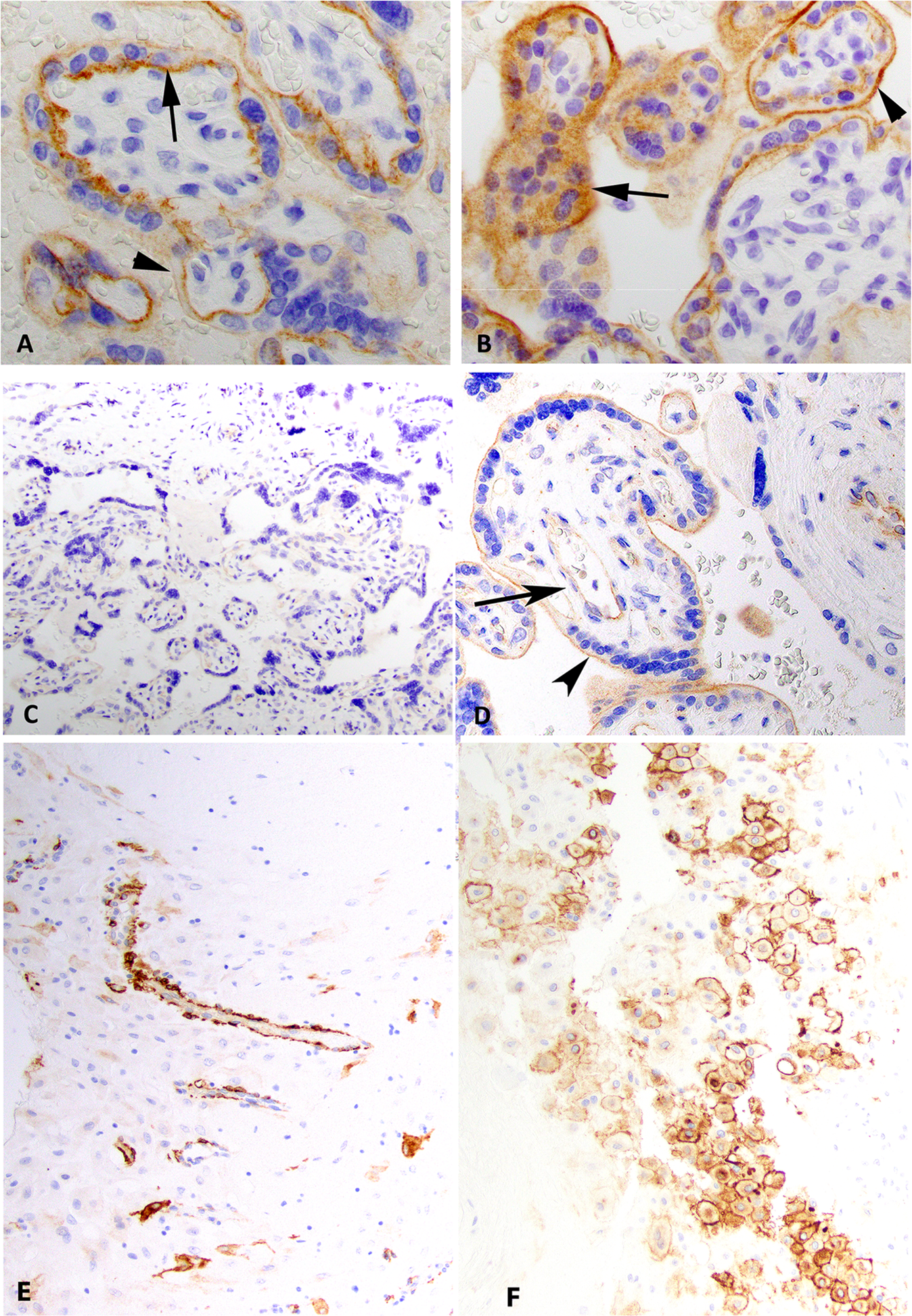 Fig. 2: ACE2 and TMPRSS2 expression.