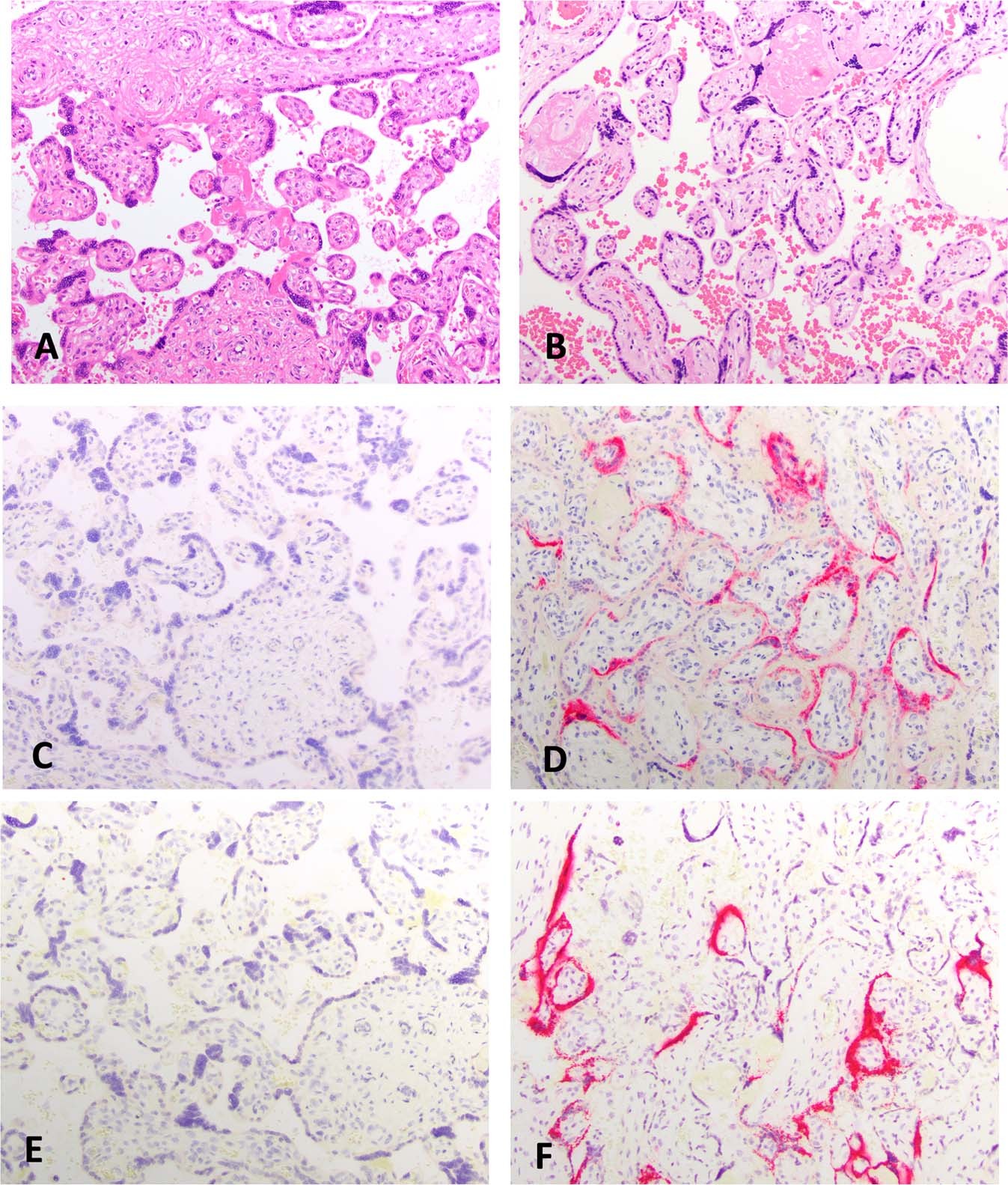 Fig. 3: Viral expression via IHC and ISH.
