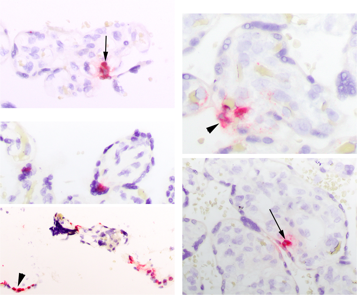 Fig. 4: Viral expression via ISH in MGH4.