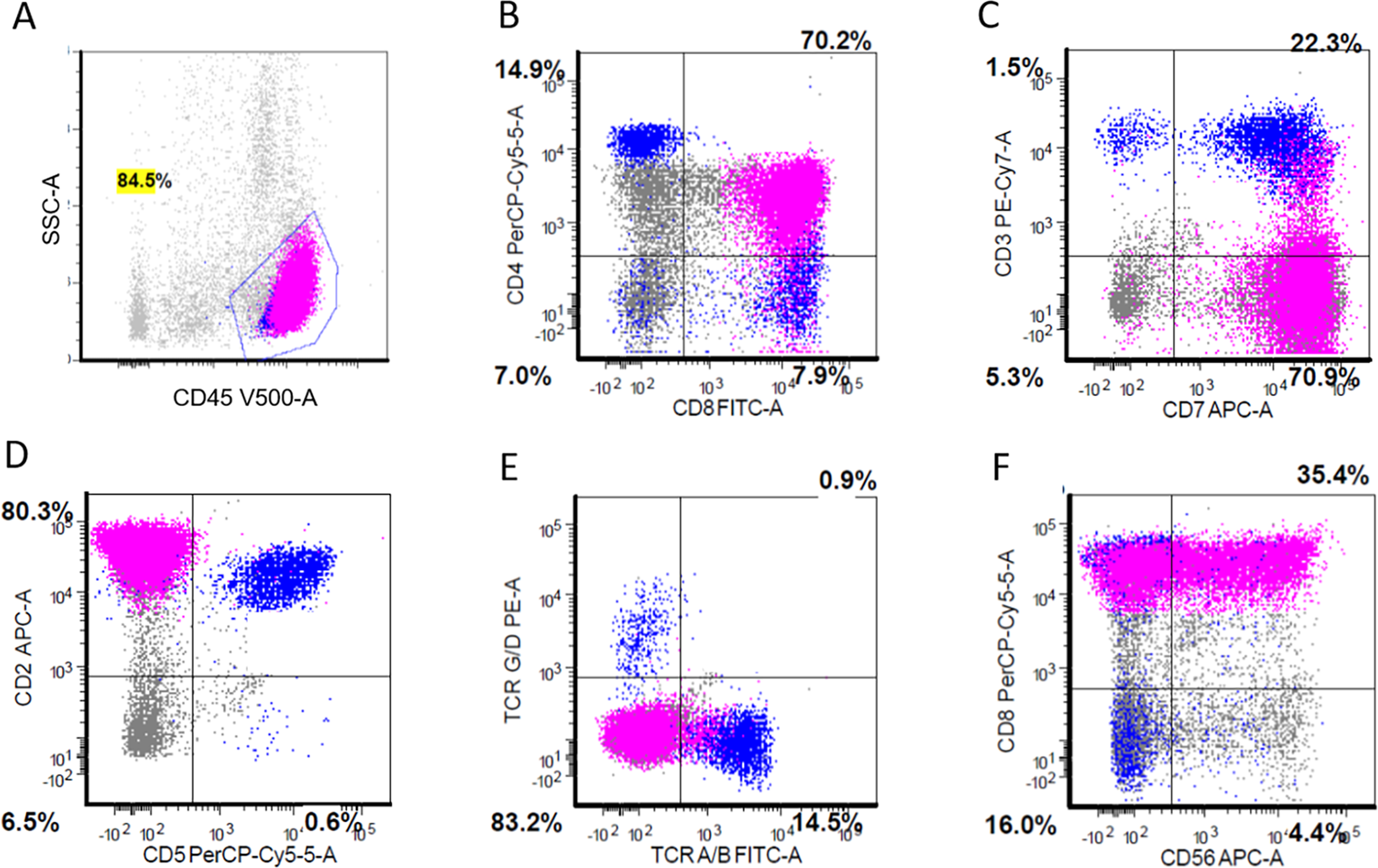 Fig. 4: Flow cytometric immunophenotypic analysis of the case shown in Fig. 1.