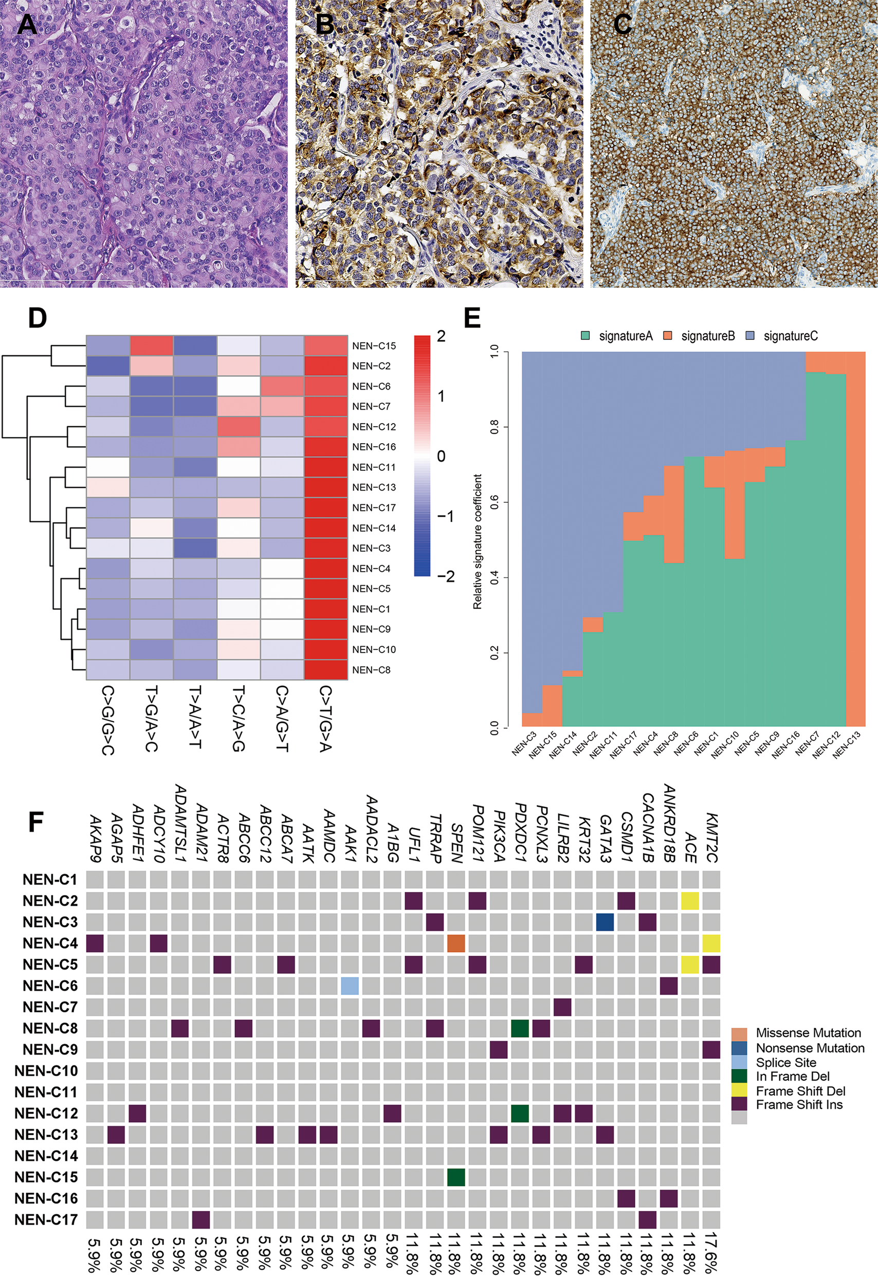 Clinical and genomic analyses of neuroendocrine neoplasms of the breast
