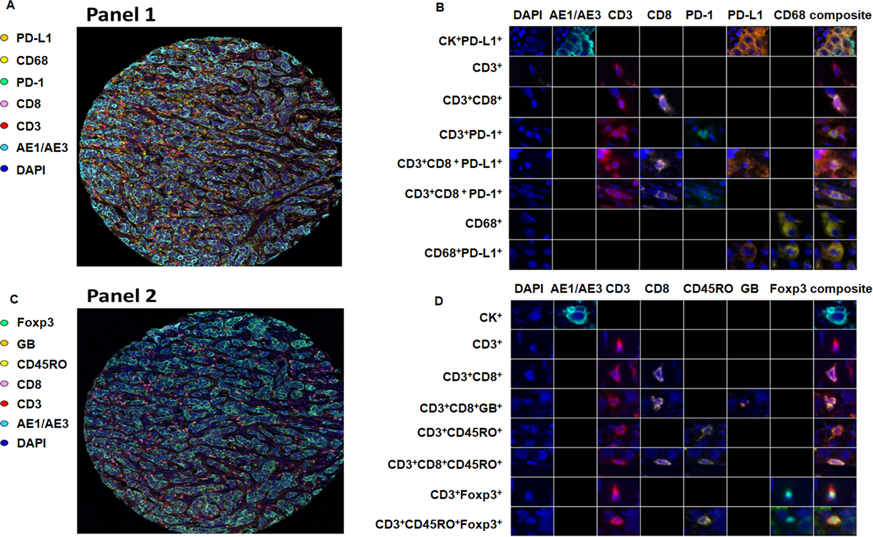 Fig. 1: Representative mIF images of TNBC cores on FFPE TMA slides.