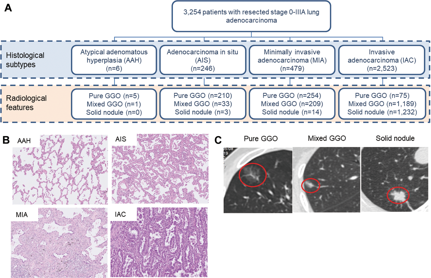 Distinct mutational features across preinvasive and invasive subtypes  identified through comprehensive profiling of surgically resected lung  adenocarcinoma | Modern Pathology