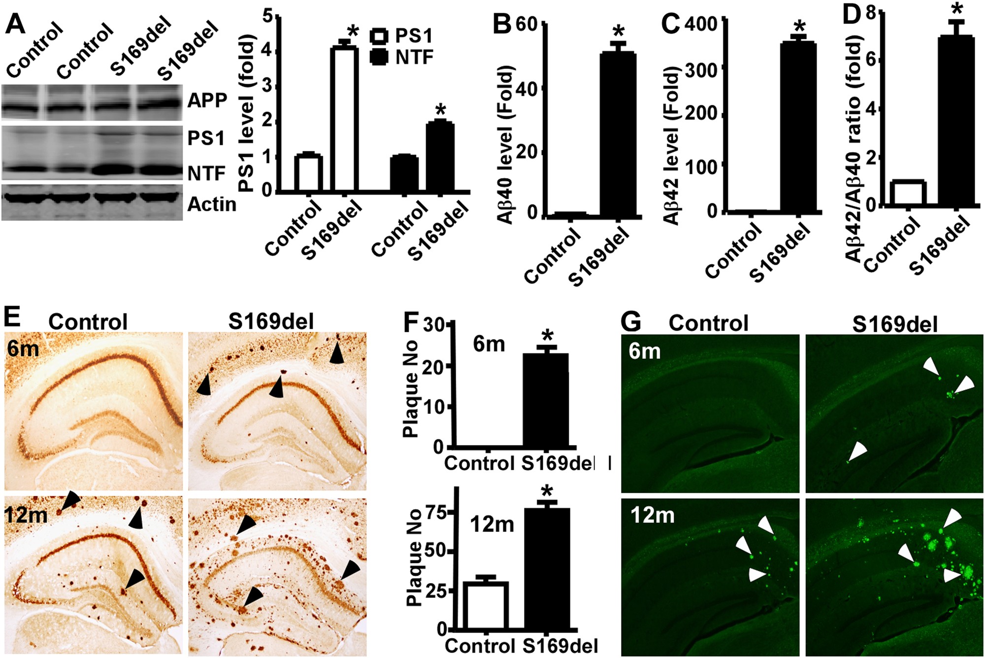A Presenilin 1 Mutation Causes Alzheimer Disease Without Affecting Notch Signaling Molecular Psychiatry A Presenilin 1 Mutation Causes Alzheimer Disease Without Affecting Notch Signaling Molecular Psychiatry