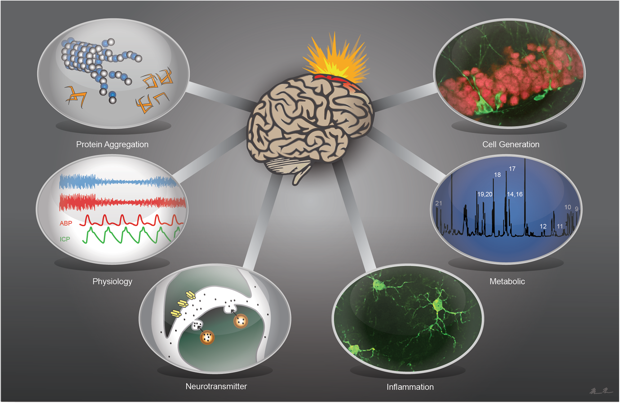 The Role of Bubbles in Brain Injury