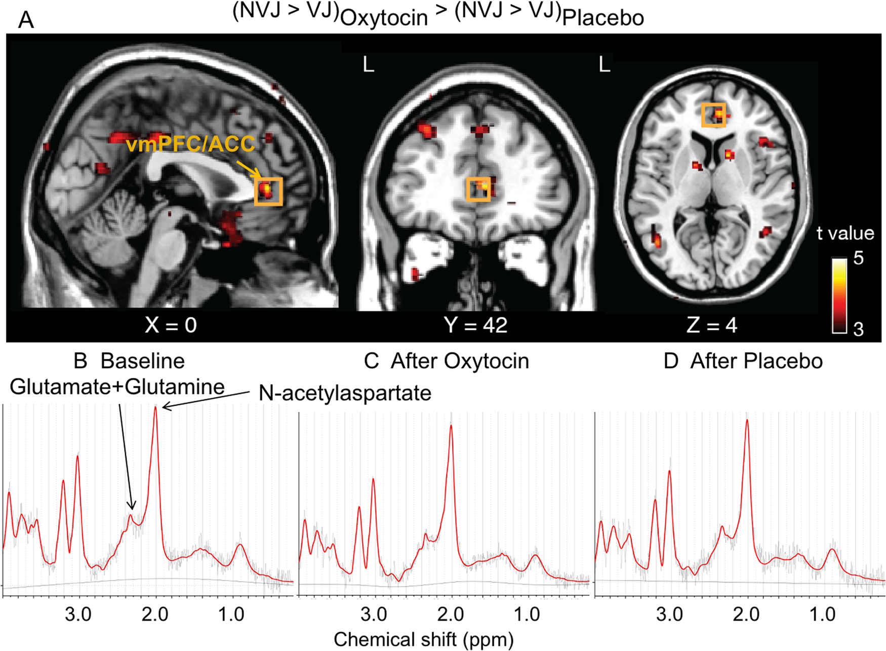 Neurochemical evidence for differential effects of acute and repeated  oxytocin administration | Molecular Psychiatry