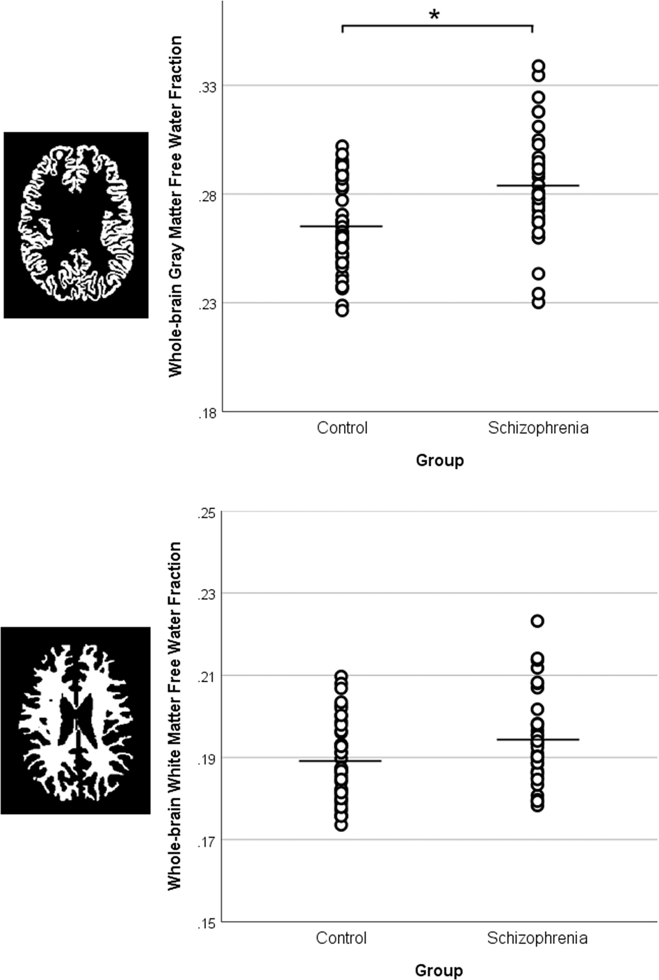 glutathione psychosis Extracellular free water and glutathione in first-episode psychosis—a  multimodal investigation of an inflammatory model for psychosis
