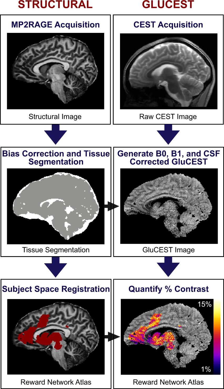 Diminished reward responsiveness is associated with lower reward network  GluCEST: an ultra-high field glutamate imaging study | Molecular Psychiatry