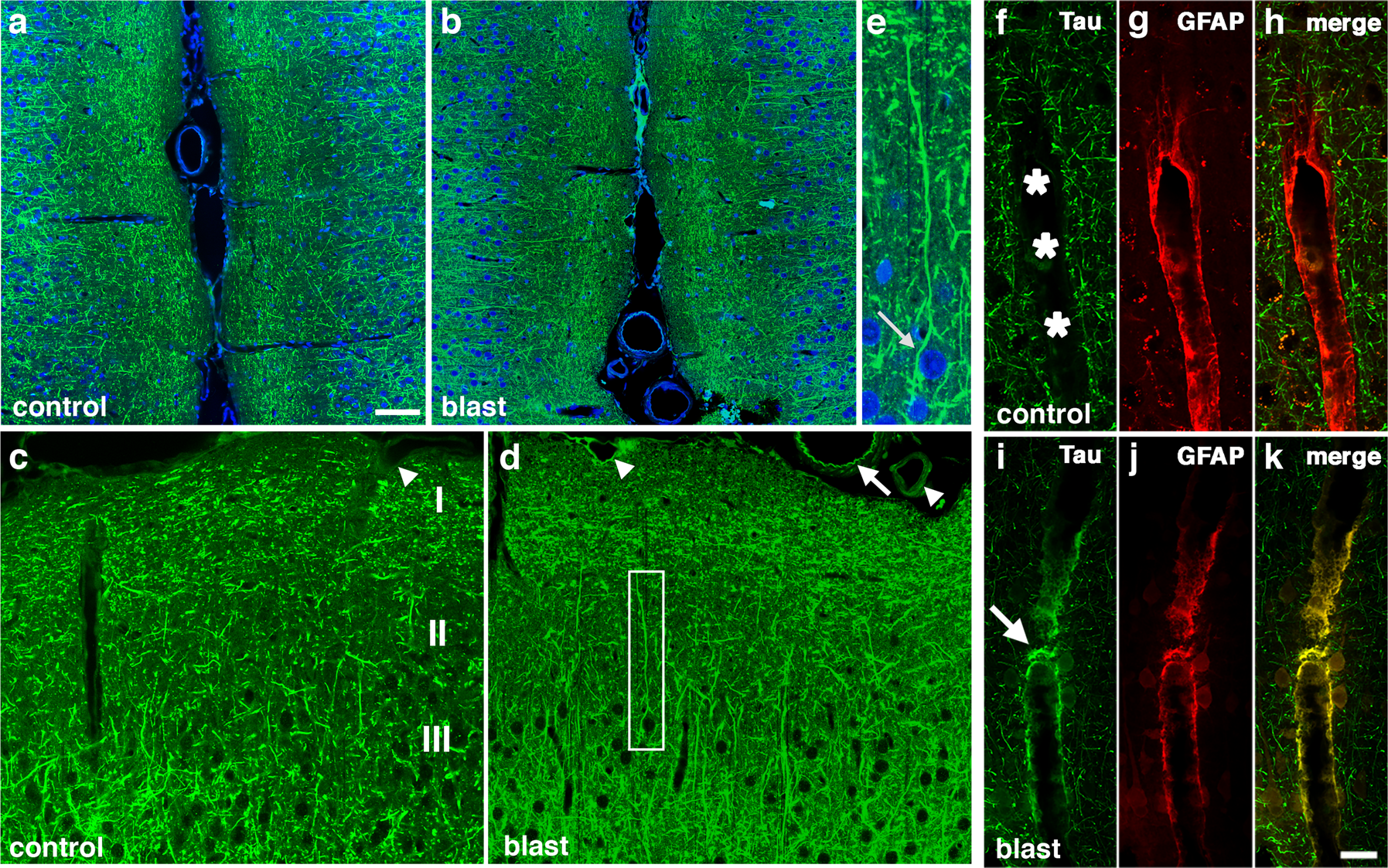 Fig. 2: Immunostaining and distribution of p-tau in blast-exposed rat brain.