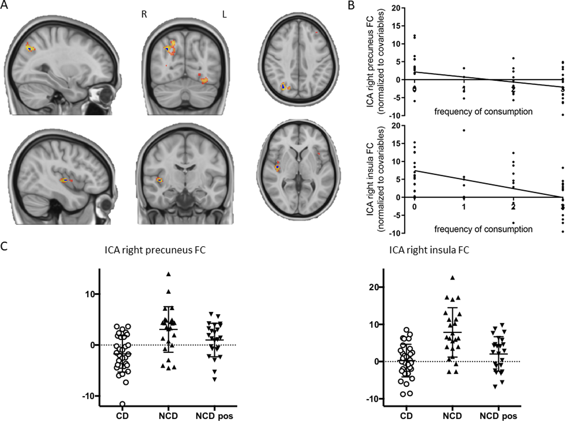 Habitual coffee drinkers display a distinct pattern of brain functional  connectivity | Molecular Psychiatry