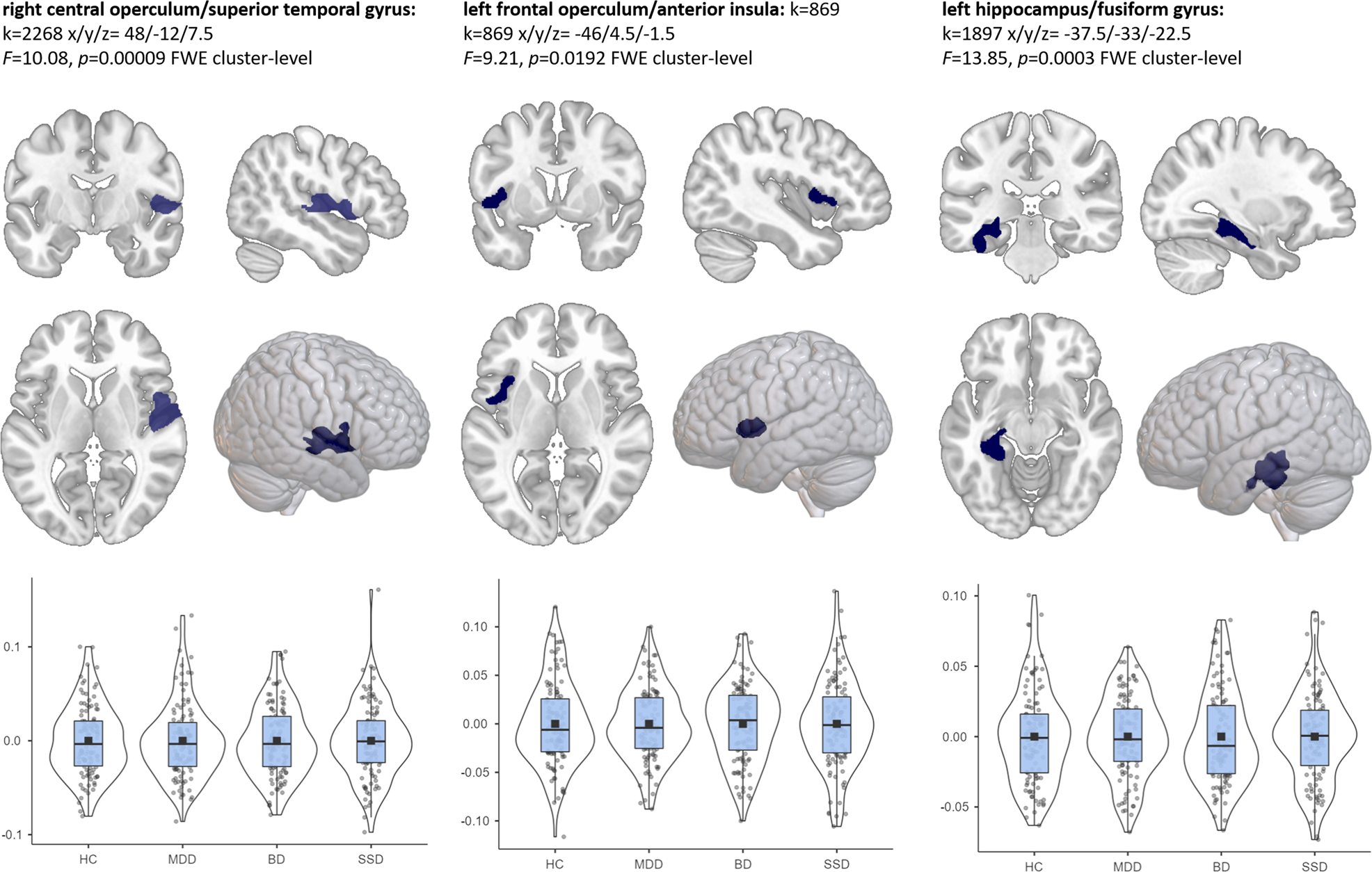 Brain aging in major depressive disorder: results from the ENIGMA