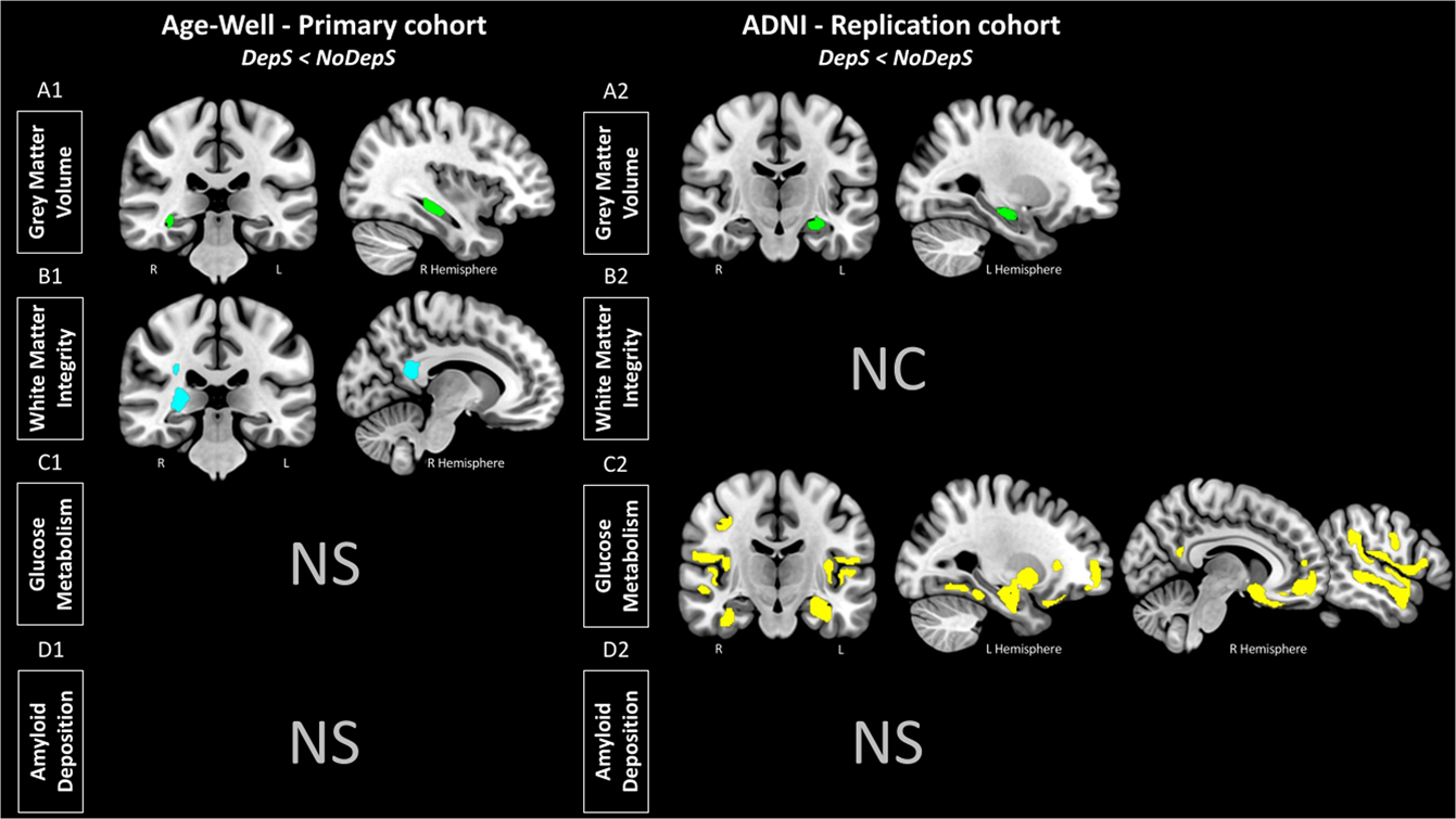 Depressive symptoms in cognitively unimpaired older adults are associated  with lower structural and functional integrity in a frontolimbic network |  Molecular Psychiatry