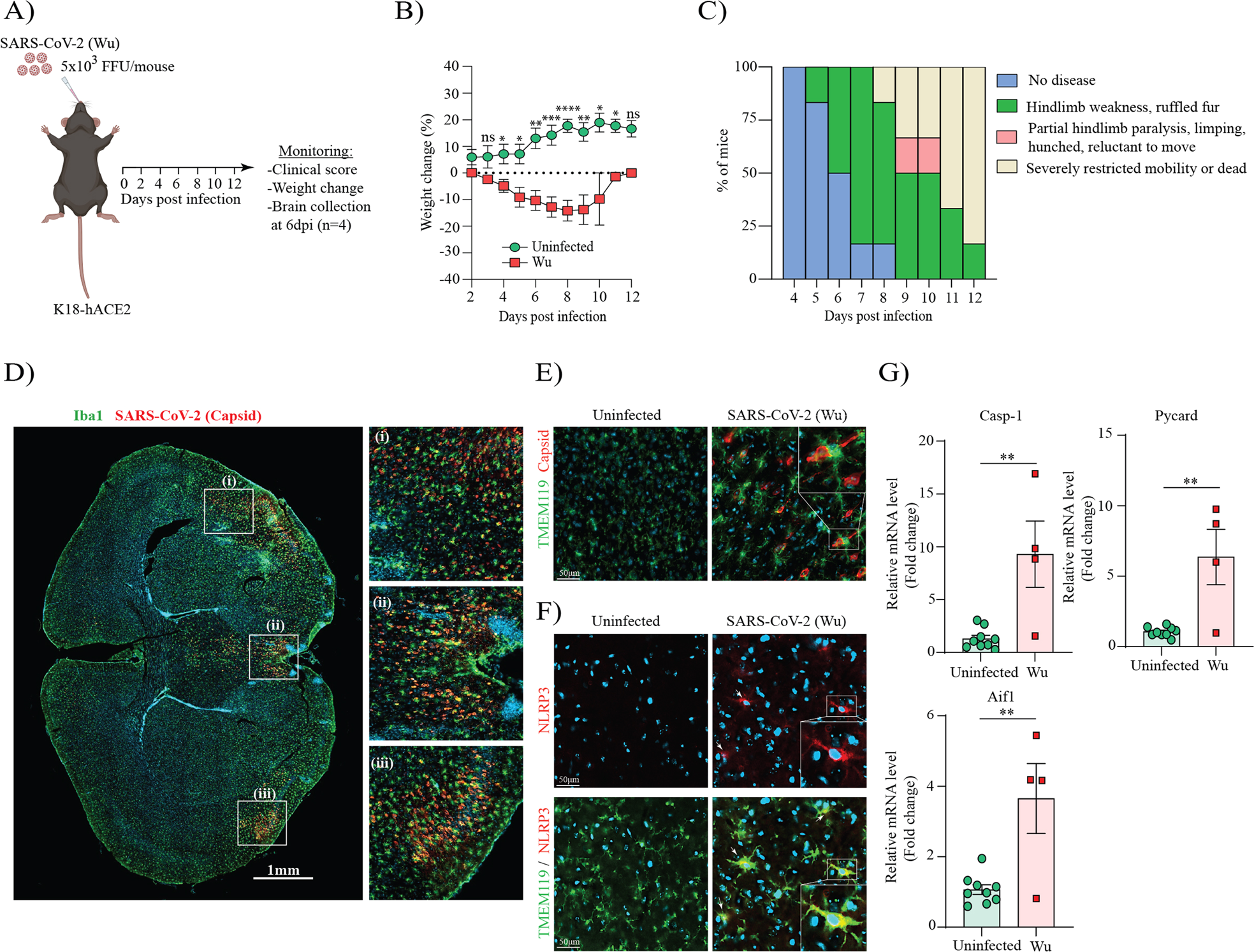 SARS-CoV-2 drives NLRP3 inflammasome activation in human microglia through spike protein