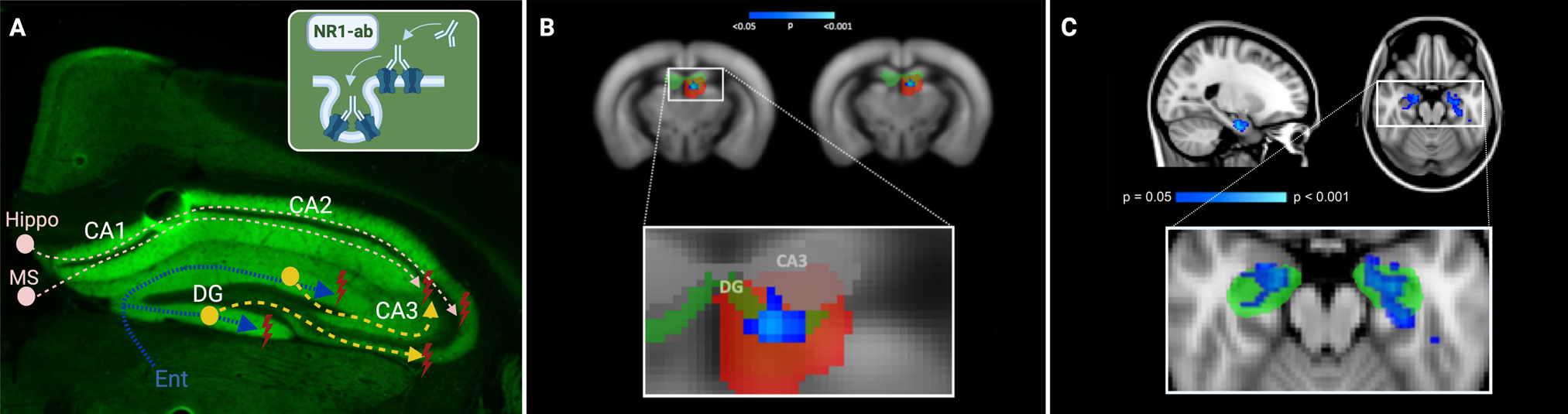 Fig. 6: Comparative pathology and MR correlates of impaired hippocampal functional connectivity in human anti-N-methyl-D-aspartate receptor (NMDAR) encephalitis and murine NMDAR antibody disease models.