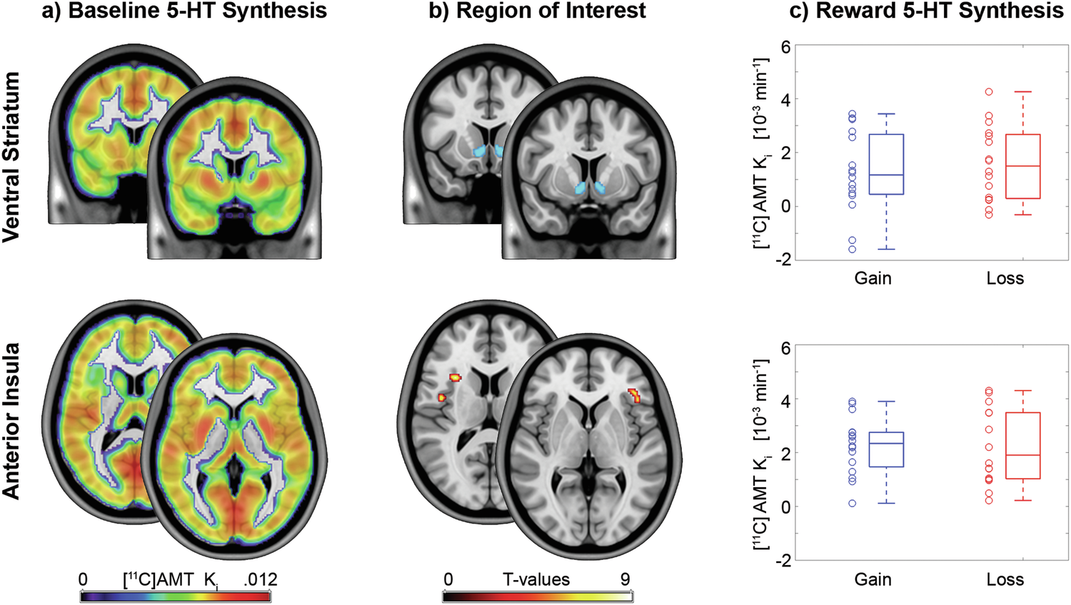 Fig. 2: Serotonin (5-HT) synthesis in the ventral striatum (VStr, top row) and anterior insula (bottom row).