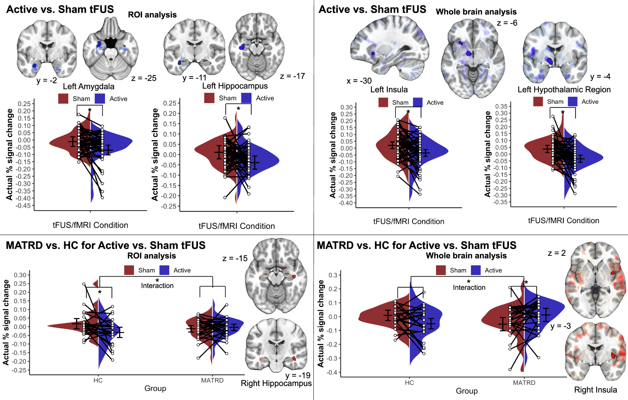 Fig. 1: Evoked effects from Active vs. Sham tFUS/fMRI and differences by Patient Group.