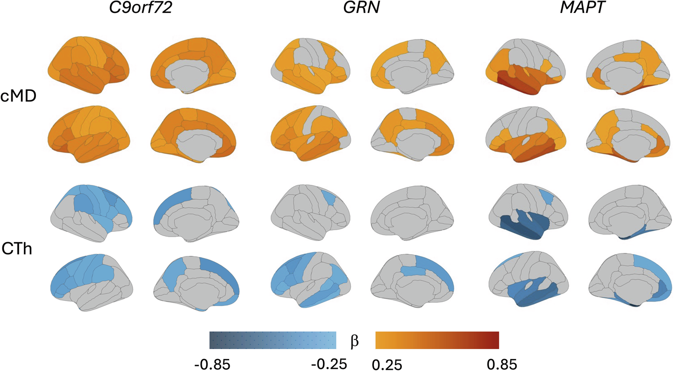 前頭側頭型認知症の早期兆候を検出する新しい脳画像技術(New brain imaging technique can detect early frontotemporal dementia)