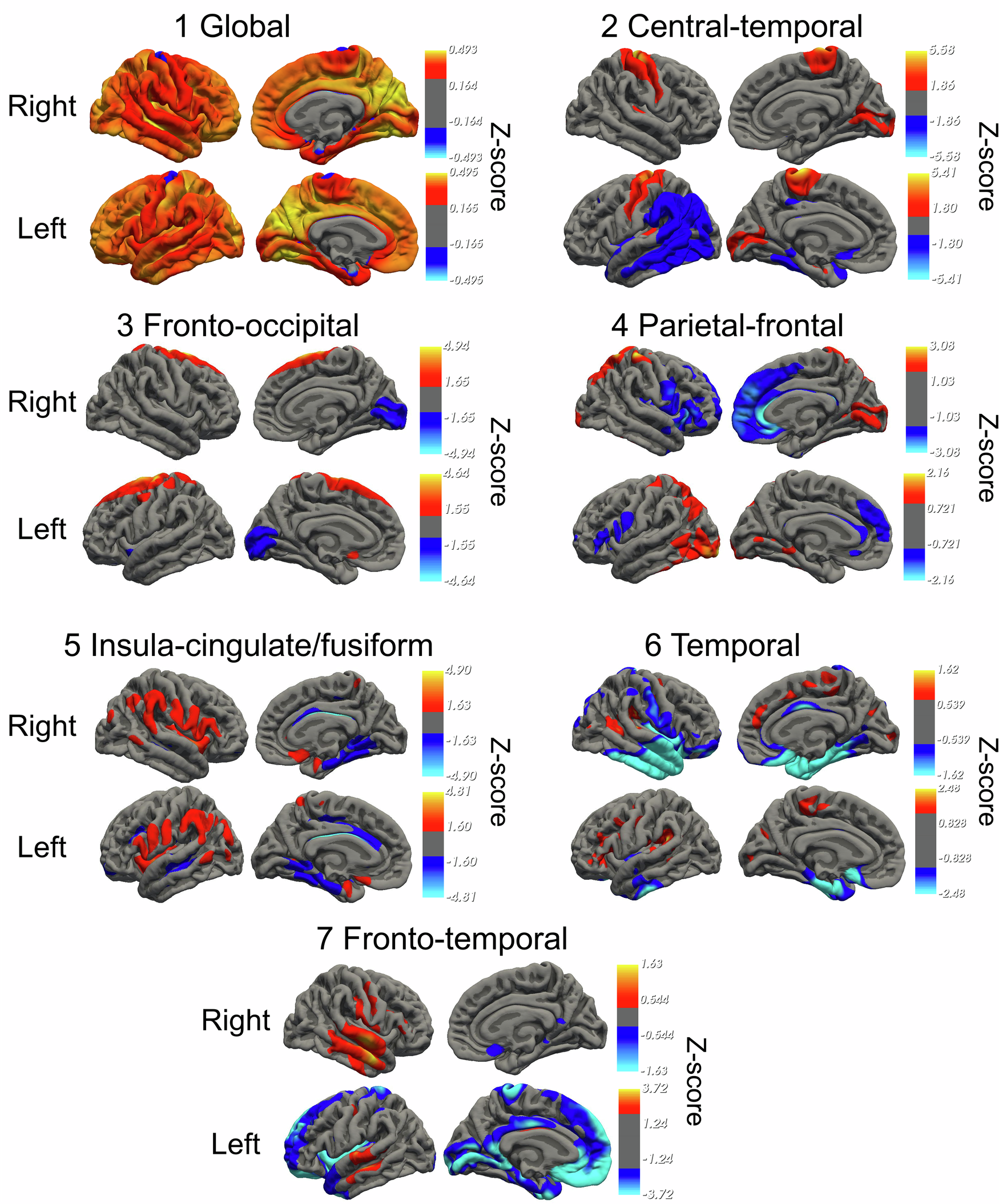Fig. 2: Maps show the spatial loading of the components, which were either dominated by a single dimension (only yellow to red color) or a negative relationship between two sets of regions marked in red and blue, respectively (values represent normalized z-scores).