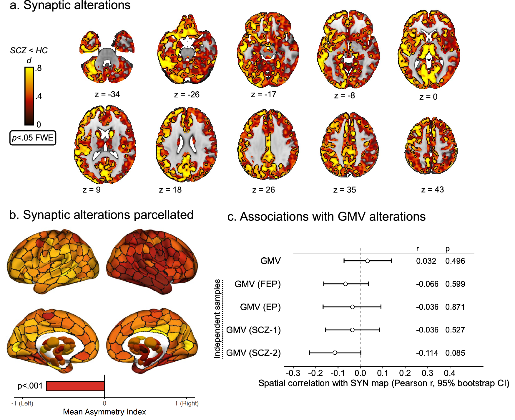Photograph accompanying Synapse PET puts schizophrenia's connection loss on a map, with a left frontal anchor