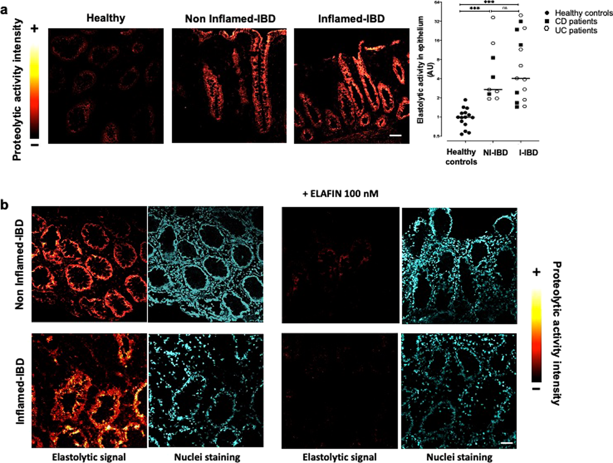 Epithelial production of elastase is increased in inflammatory bowel  disease and causes mucosal inflammation | Mucosal Immunology