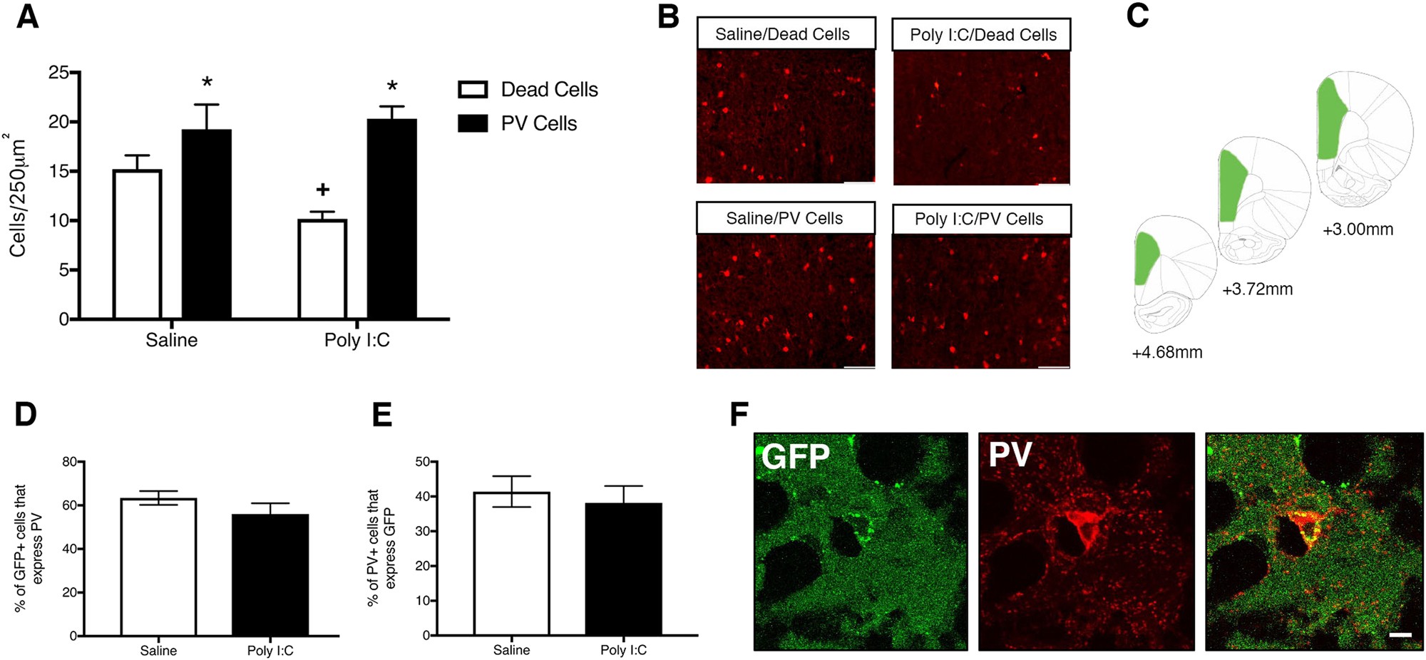 Embryonic stem cell transplants as a therapeutic strategy in a rodent model  of autism | Neuropsychopharmacology