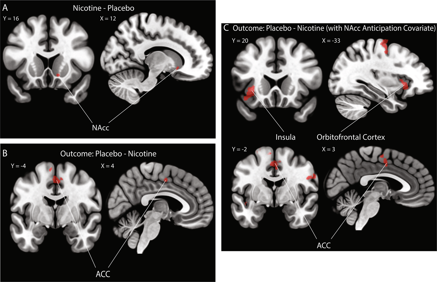 The acute effects of nicotine on corticostriatal responses to distinct  phases of reward processing | Neuropsychopharmacology