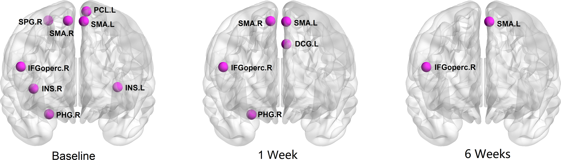Fig. 2: Graphs show the regions with significantly altered nodal centralities of the brain structural connectome in patients with bipolar disorder when compared with health controls at different time points.