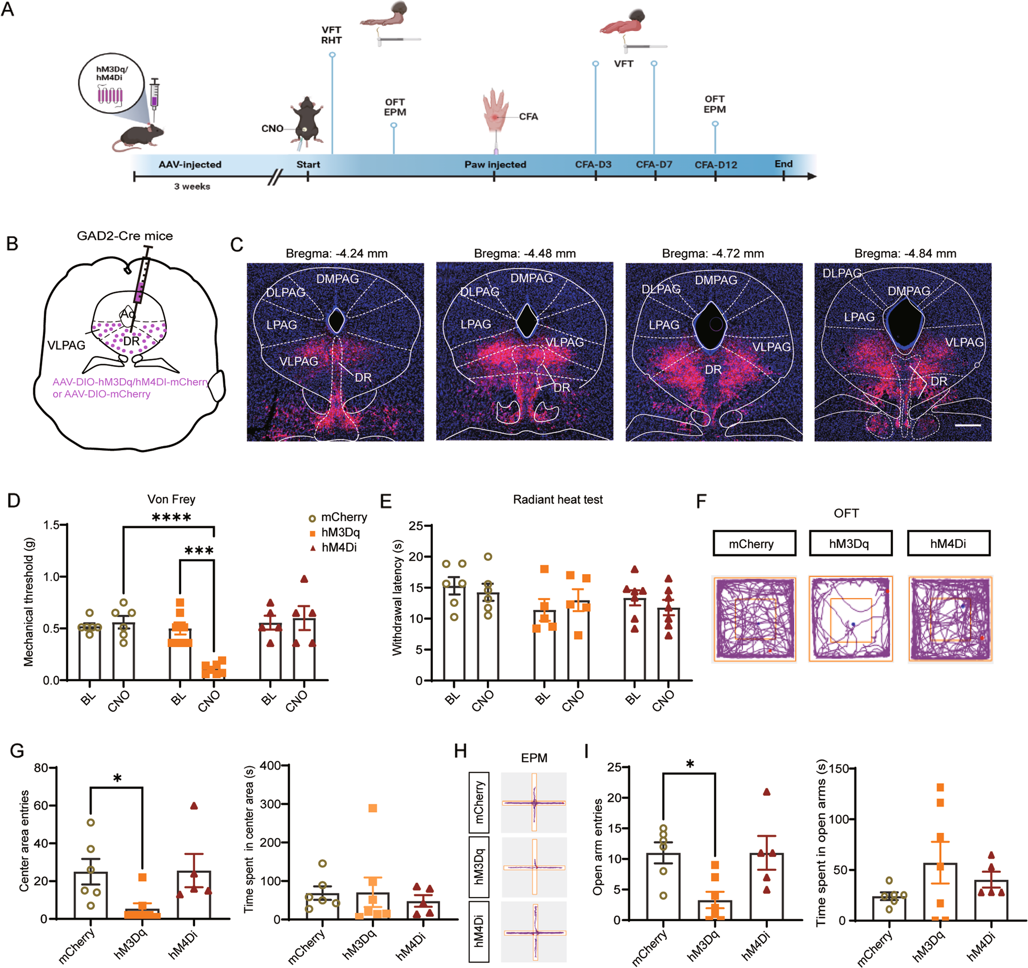The Cerebral Signature for Pain Perception and Its Modulation: Neuron, image size:2071x1951