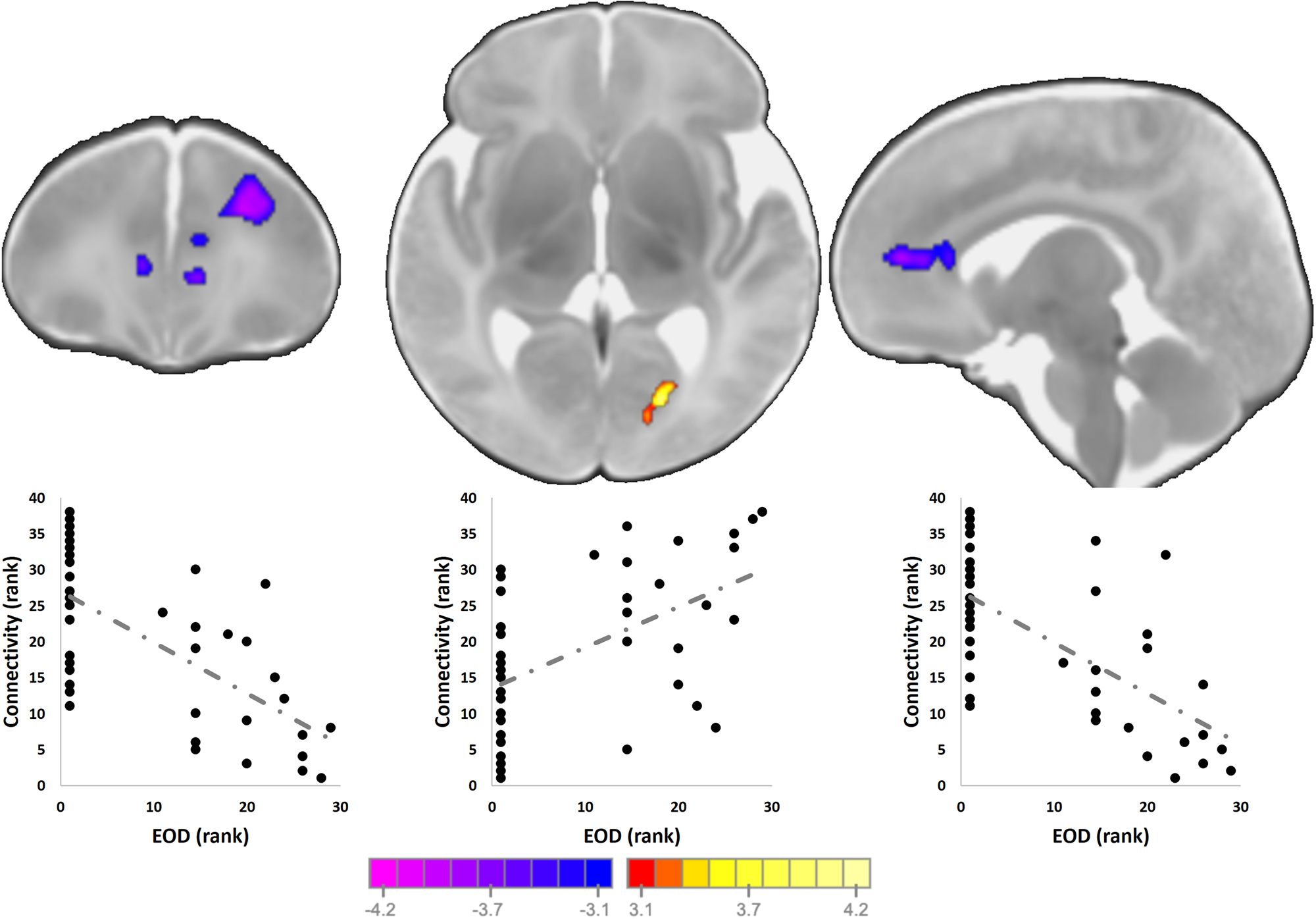 Fig. 3: Associations prenatal experiences of discrimination and offspring amygdala connectivity.
