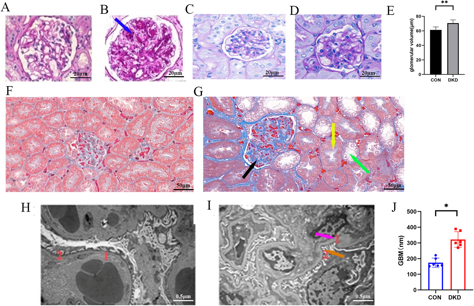 Fig. 1: Establishment of the DKD experimental mouse model.
