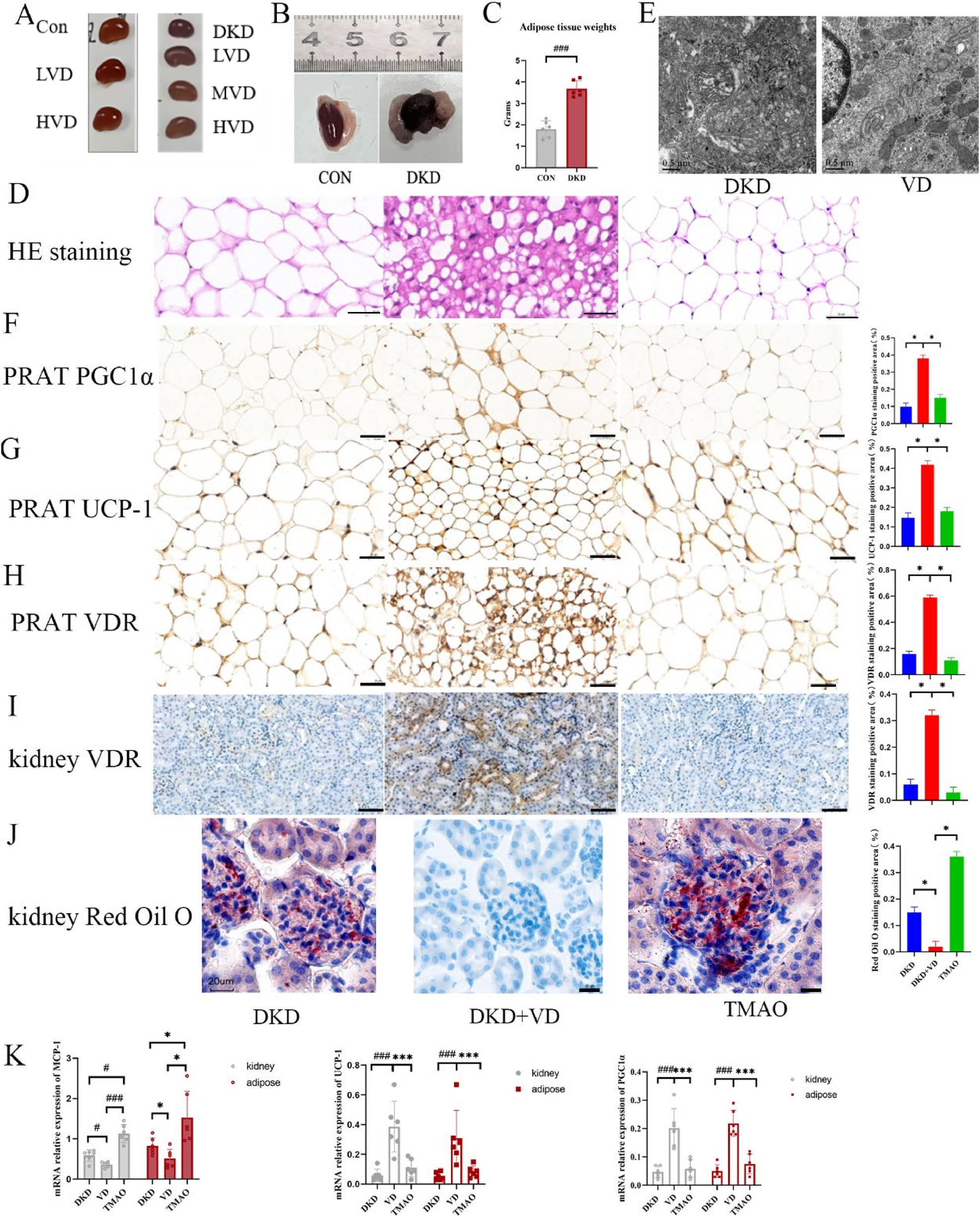 Fig. 3: VD played a role in the effect of TMAO on perirenal fat and kidney in mice with DKD.