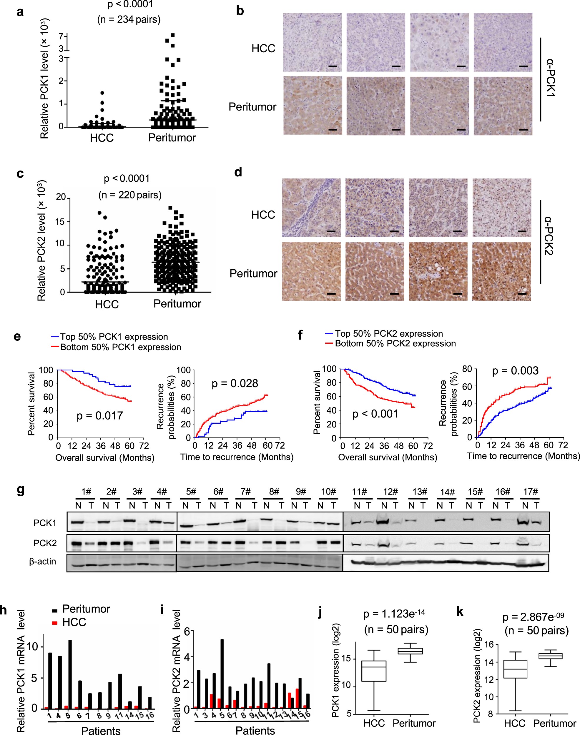Metabolic reprogramming by PCK1 promotes TCA cataplerosis, oxidative stress  and apoptosis in liver cancer cells and suppresses hepatocellular carcinoma  | Oncogene