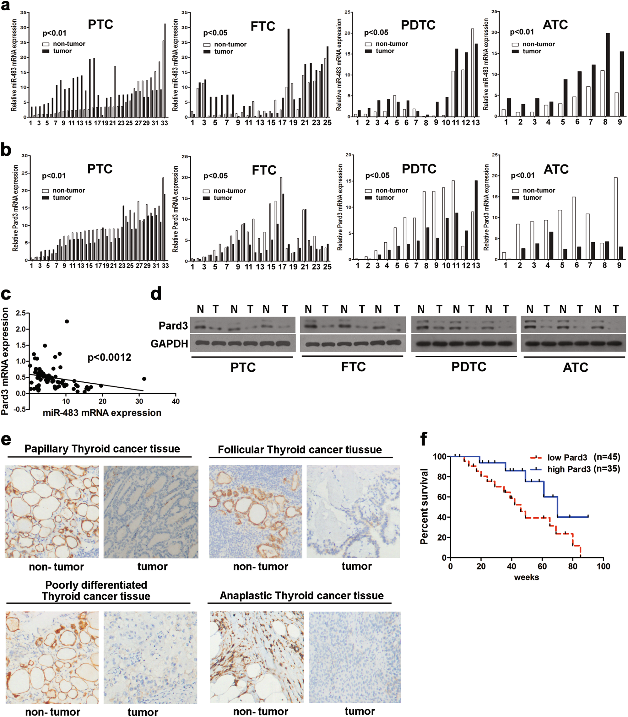 Role of MMP-9 in epithelial-mesenchymal transition of thyroid cancer, World Journal of Surgical Oncology