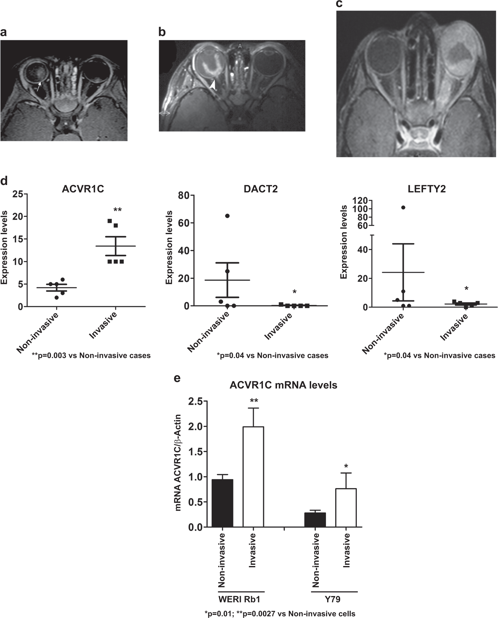 Picture of ACVR1C