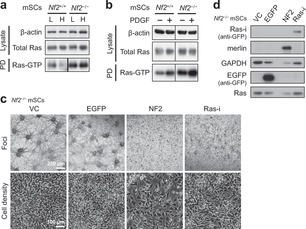 The NF2 tumor suppressor merlin interacts with Ras and RasGAP, which may  modulate Ras signaling | Oncogene
