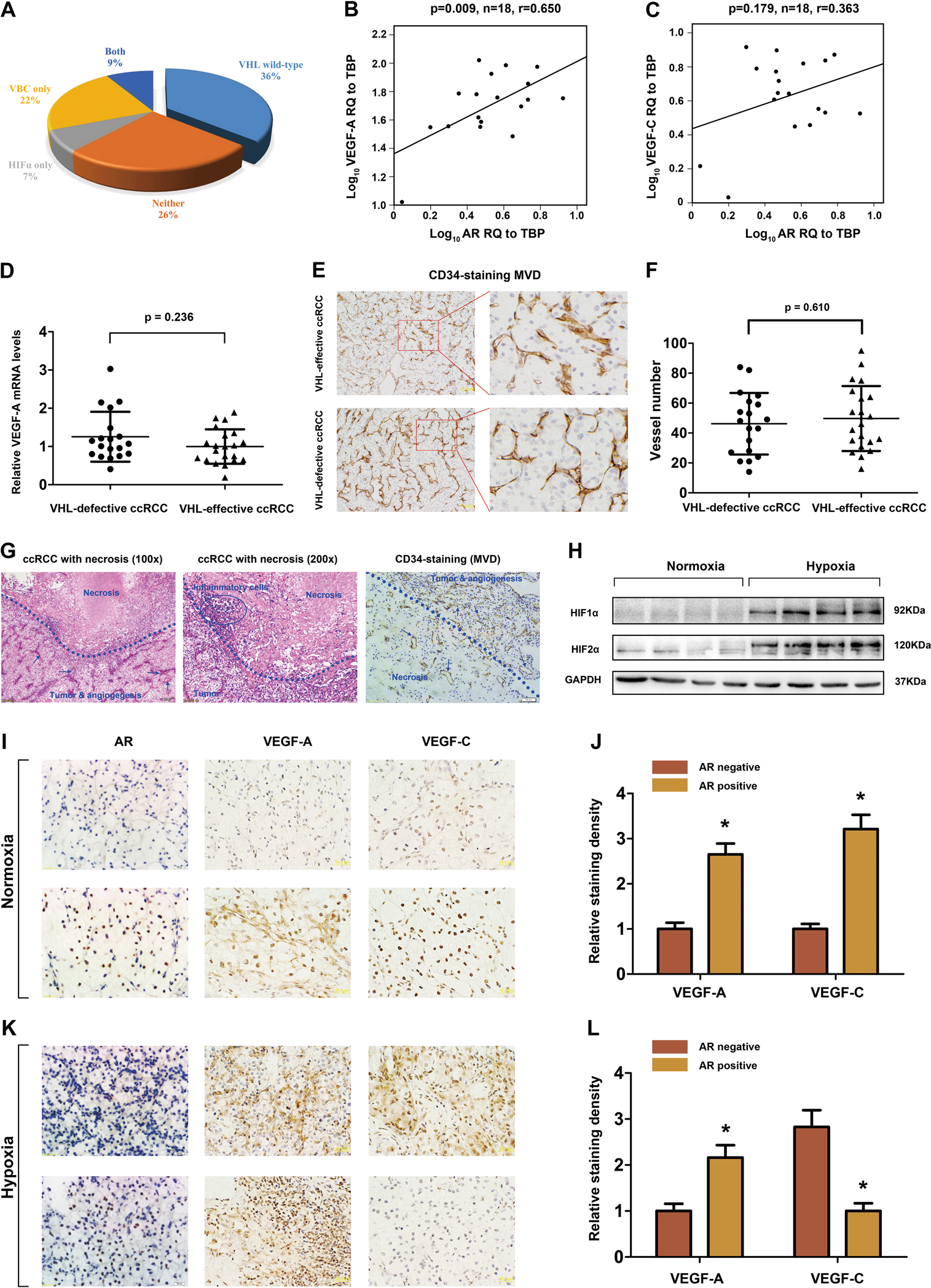 Androgen receptor modulates metastatic routes of VHL wild-type clear cell renal cell carcinoma in an oxygen-dependent manner Oncogene