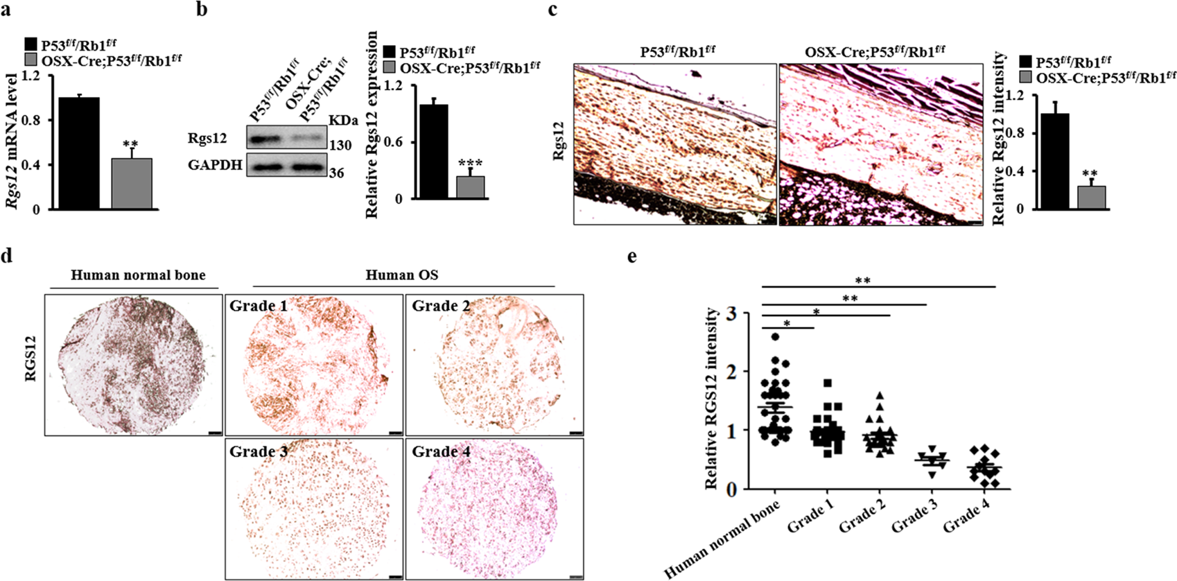 064D11■SX　RG1 FR/VS　リゾネーター■ SX Reso 1 CE FR VS Resonator