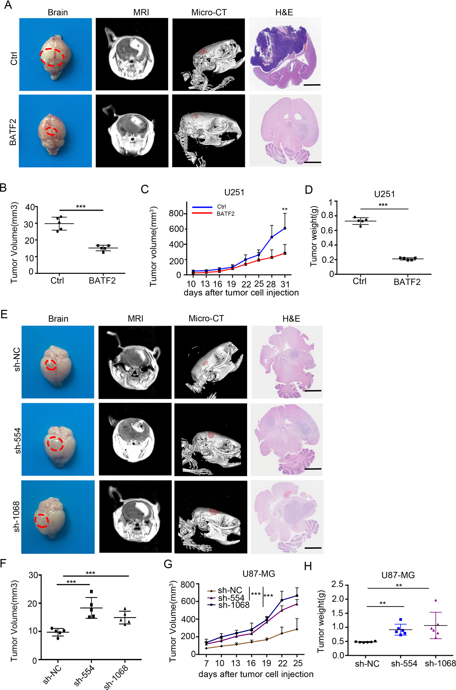 Batf2 Prevents Glioblastoma Multiforme Progression By Inhibiting Recruitment Of Myeloid Derived Suppressor Cells Oncogene