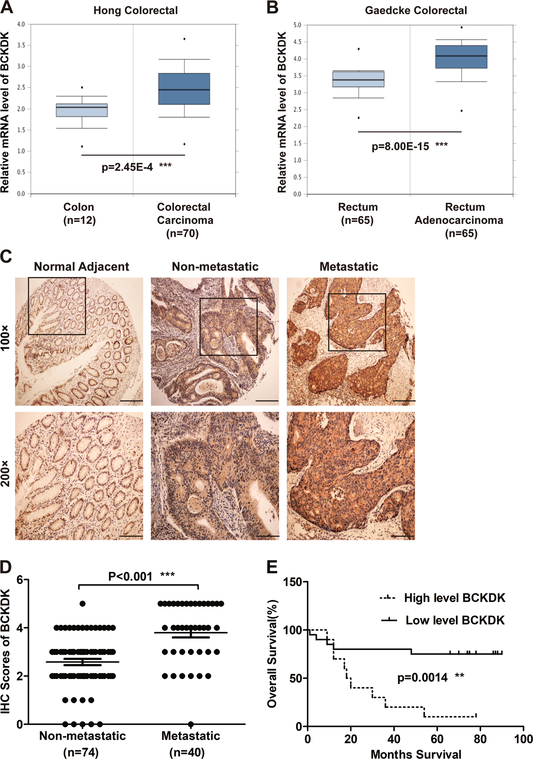 Fig. 1: BCKDK is upregulated in mCRC and associated with poor prognosis of CRC patients.