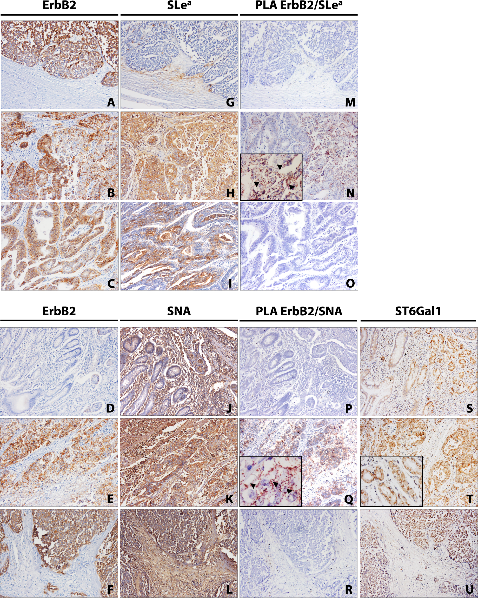 ST6Gal1 targets the ectodomain of ErbB2 in a site-specific manner and  regulates gastric cancer cell sensitivity to trastuzumab | Oncogene