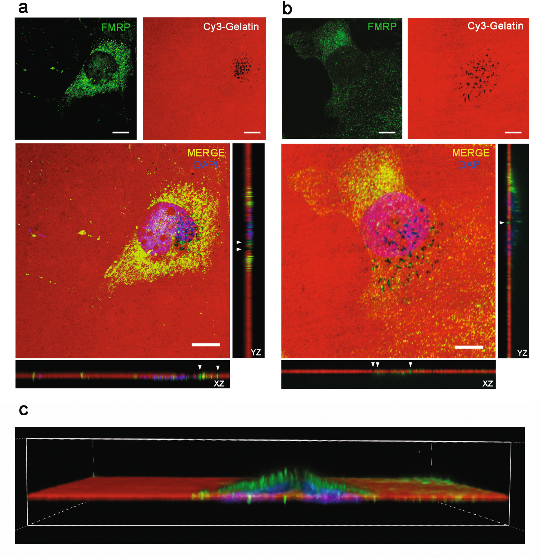 Fig. 4: FMRP is localized inside invadopodia of HuH28 and HuCCT cells.