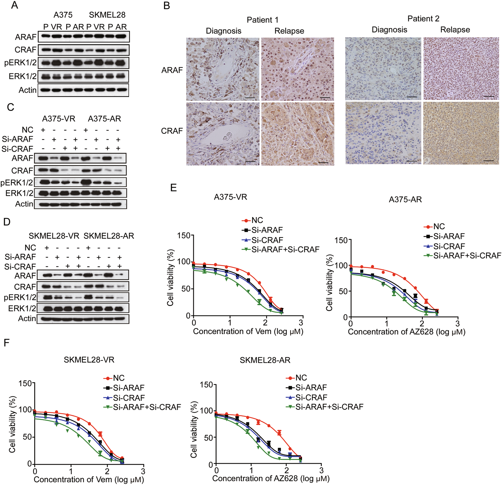 Targeting the p300/NONO axis sensitizes melanoma cells to BRAF  