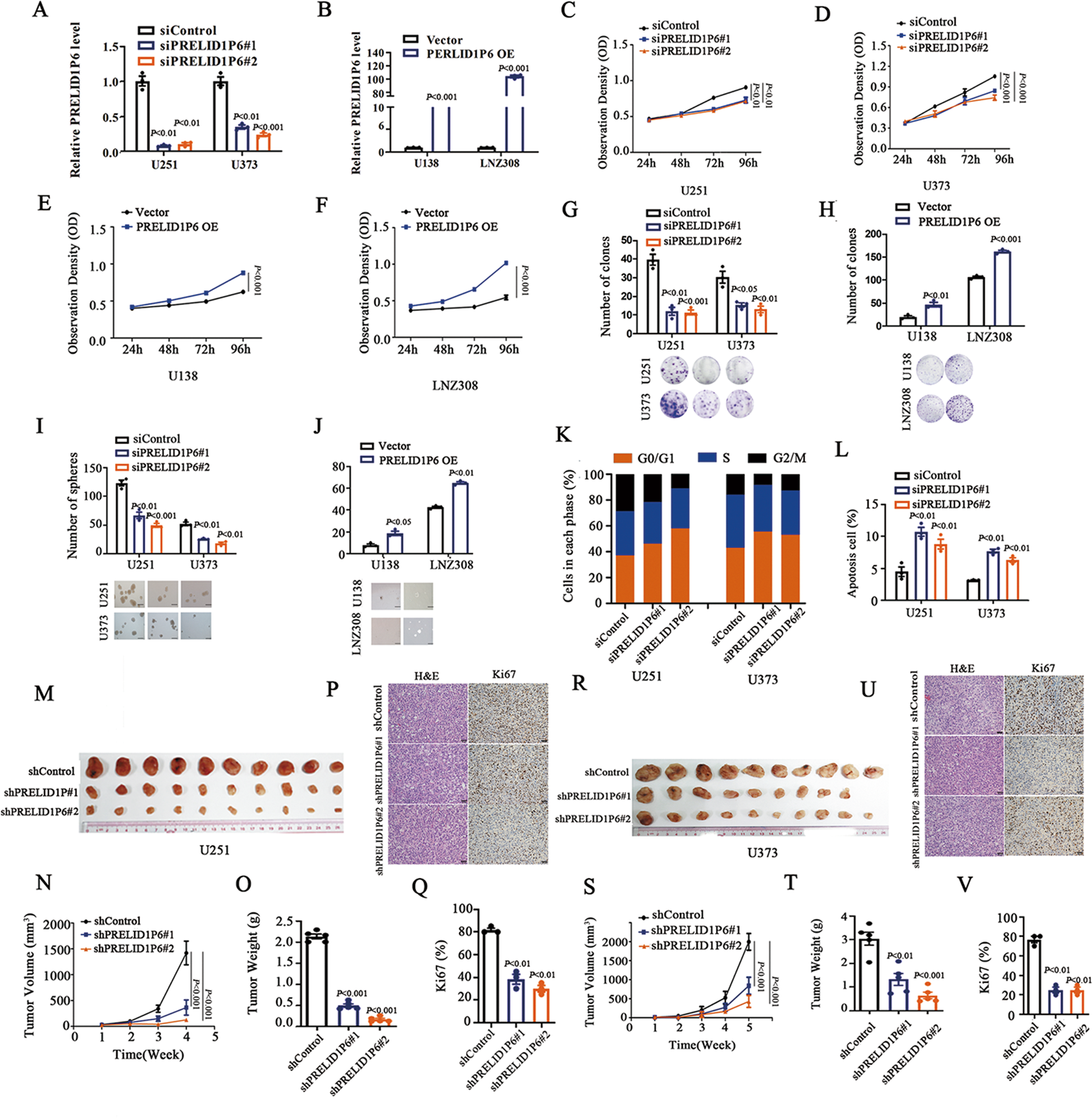 Fig. 2: Knockdown of PRELID1P6 significantly decreases glioma cell proliferation in vitro and in vivo.