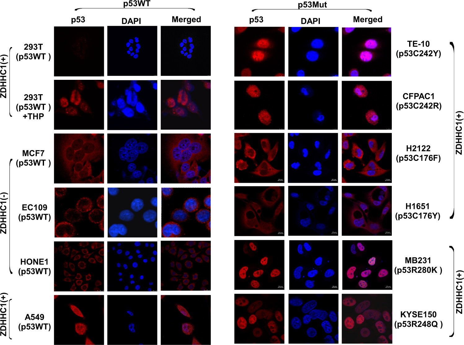 Fig. 6: ZDHHC1 and p53 mutations determine p53 localization.