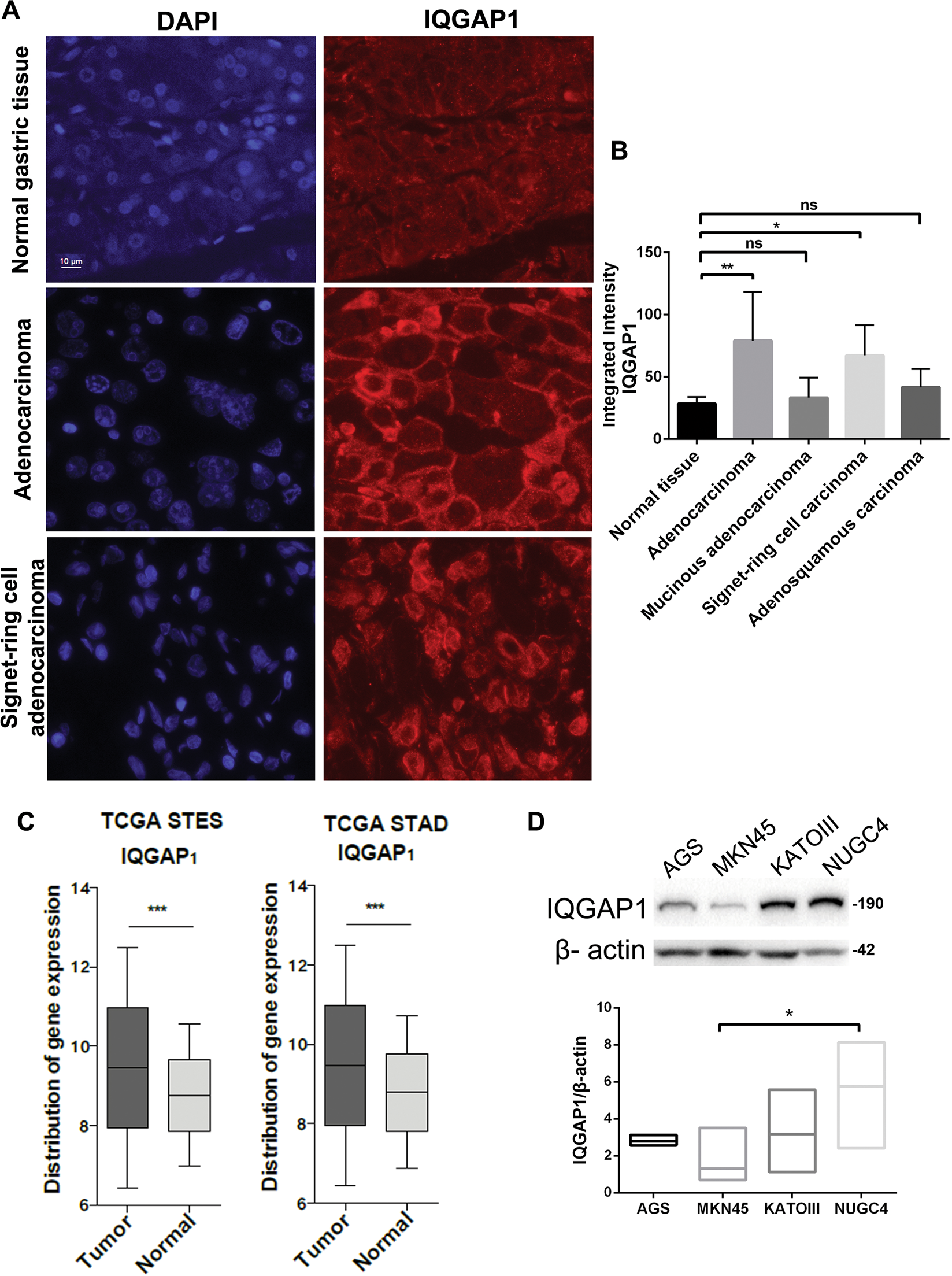 The scaffold protein IQGAP1 links heat-induced stress signals to
