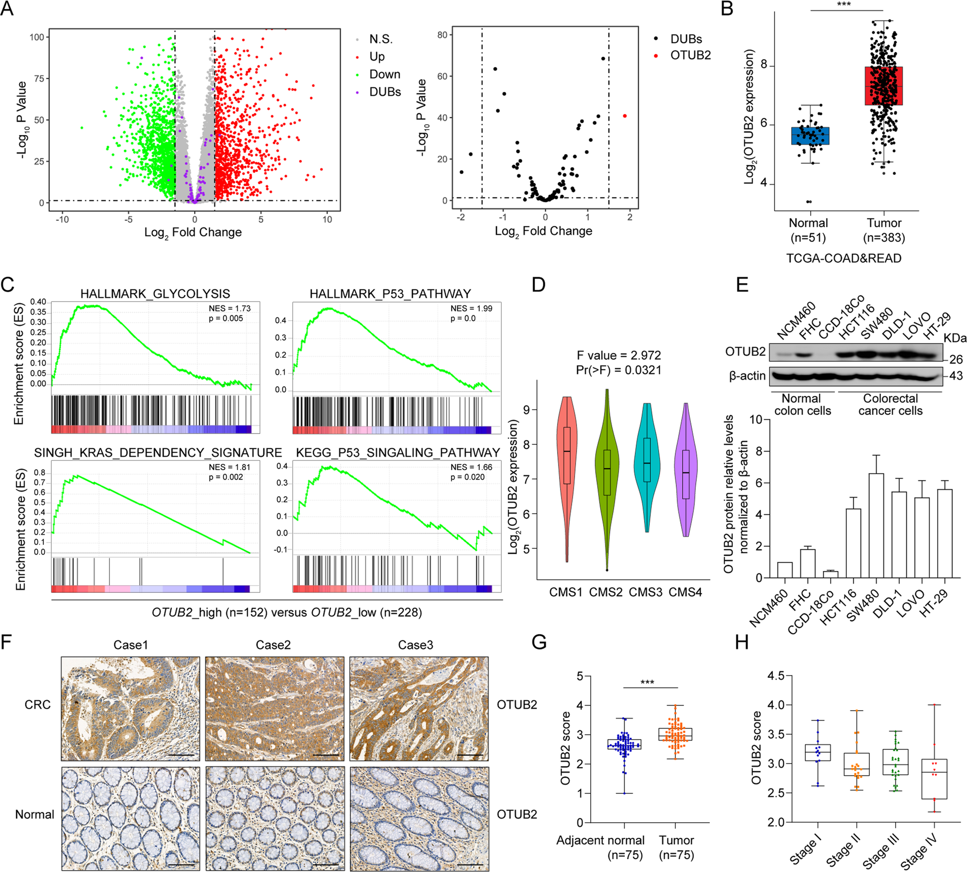 Deubiquitinase Otub2 Exacerbates The Progression Of Colorectal Cancer By Promoting Pkm2 Activity And Glycolysis Oncogene