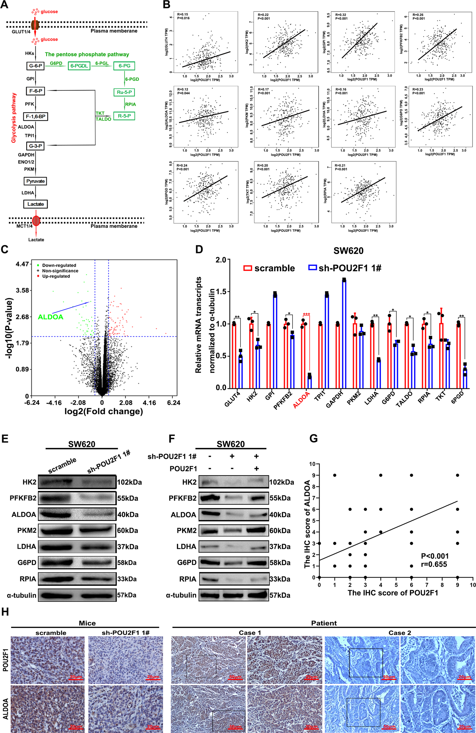 Fig. 4: POU2F1 enhances the expression of ALDOA in colon cancer cells.