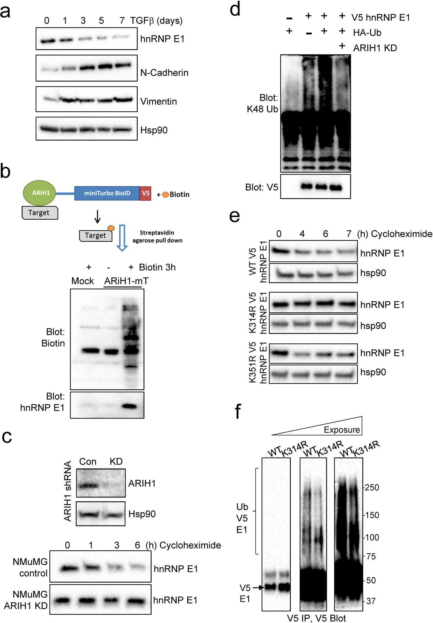 The ubiquitin E3 ligase ARIH1 regulates hnRNP E1 protein stability, EMT and  breast cancer progression | Oncogene